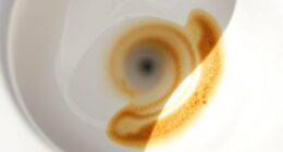 remove toilet bowl stains